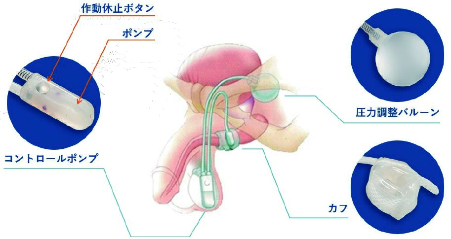 UrologicSurgeryNext 尿路変向・再建術 尿路変向・再建術 (Urologic Surgery Next 5) | 荒井 陽一 |本