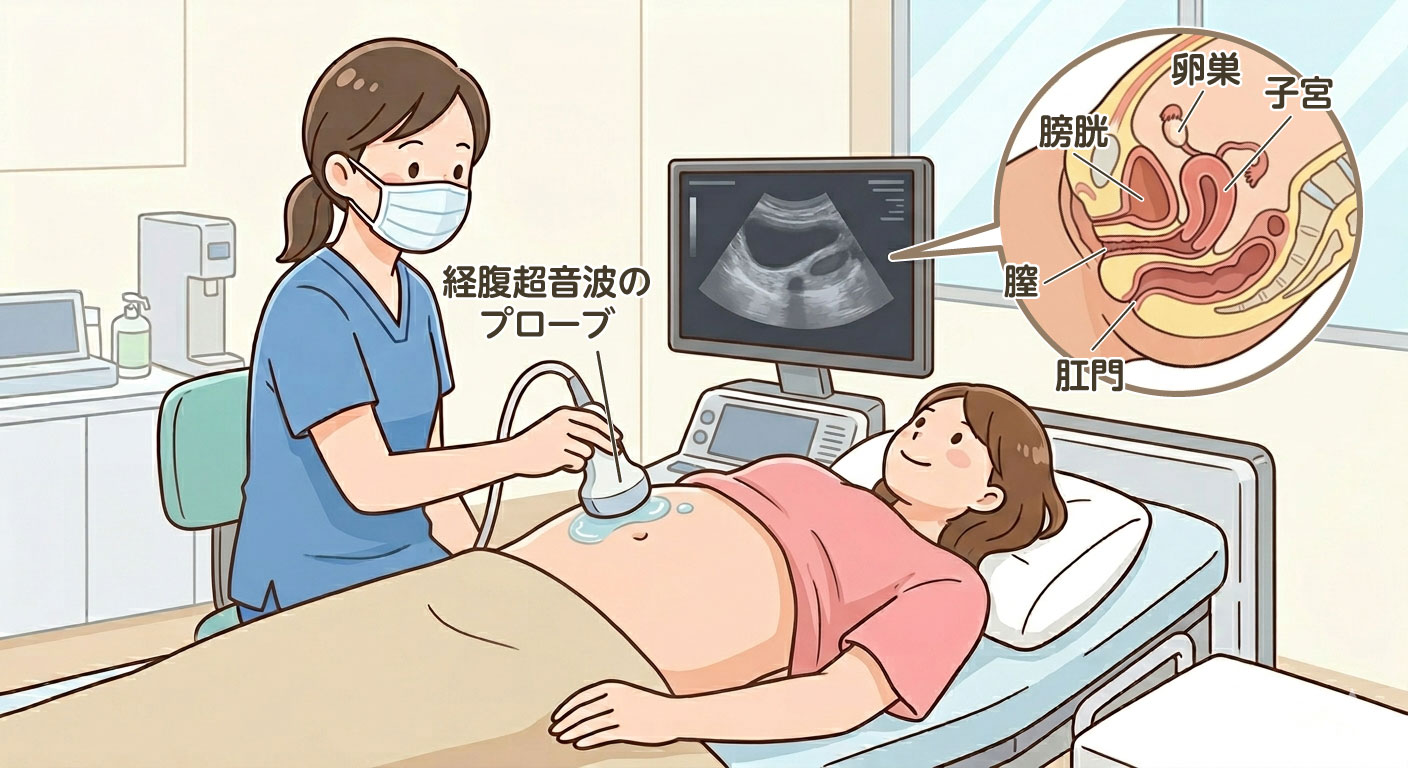 経腹超音波検査（エコー）説明